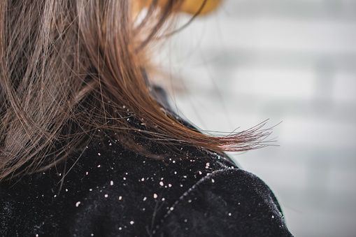 Everything You Need to Know About Dandruff Shampoos, Plus 15 Recommendations